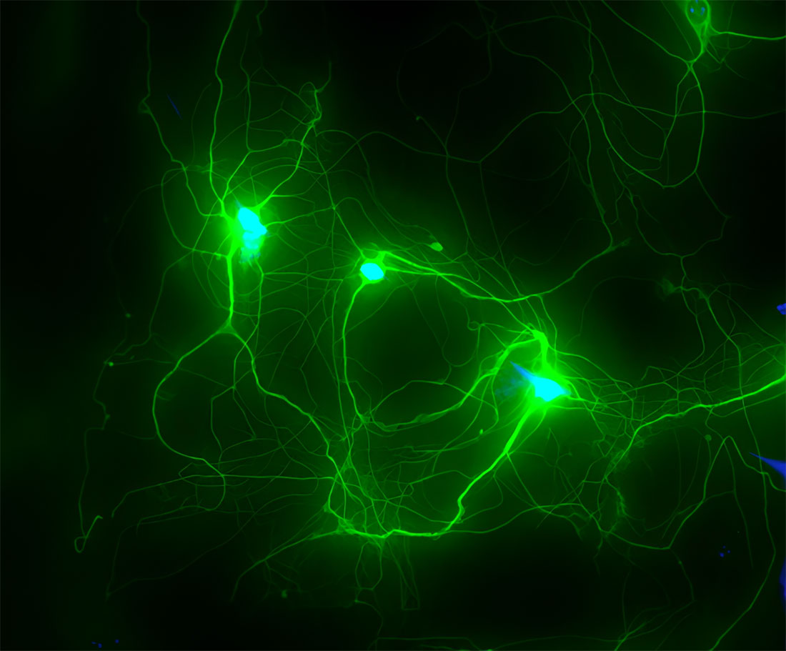 growing-human-neurons-aos.jpeg